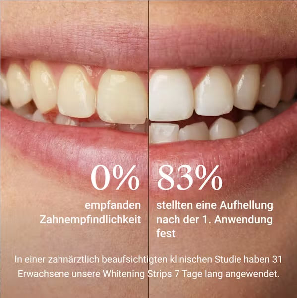 Premium Whitening Strips – Strahlend weiße Zähne | WhiteAura